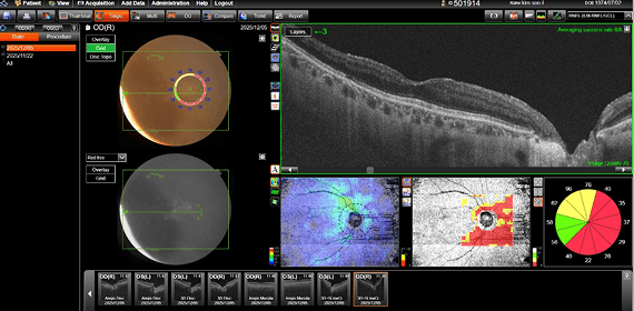 김OO 수술 전 검사