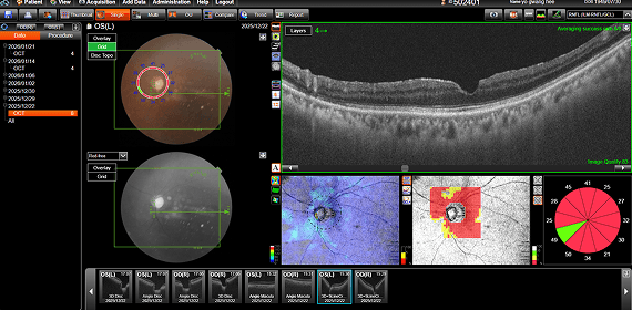 유OO 수술 전 검사