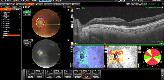 이OO 수술 전 검사