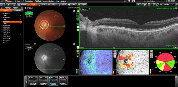 이OO 수술 후 검사