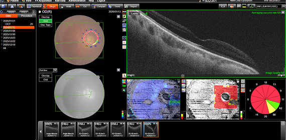 최OO 수술 후 검사