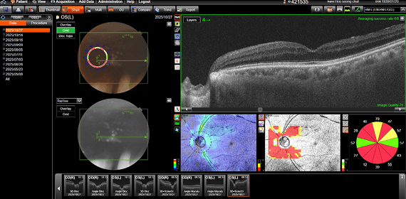 허OO 수술 전 검사