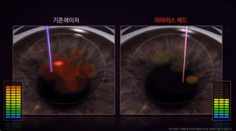 0.54mm 최소 레이저빔 사이즈