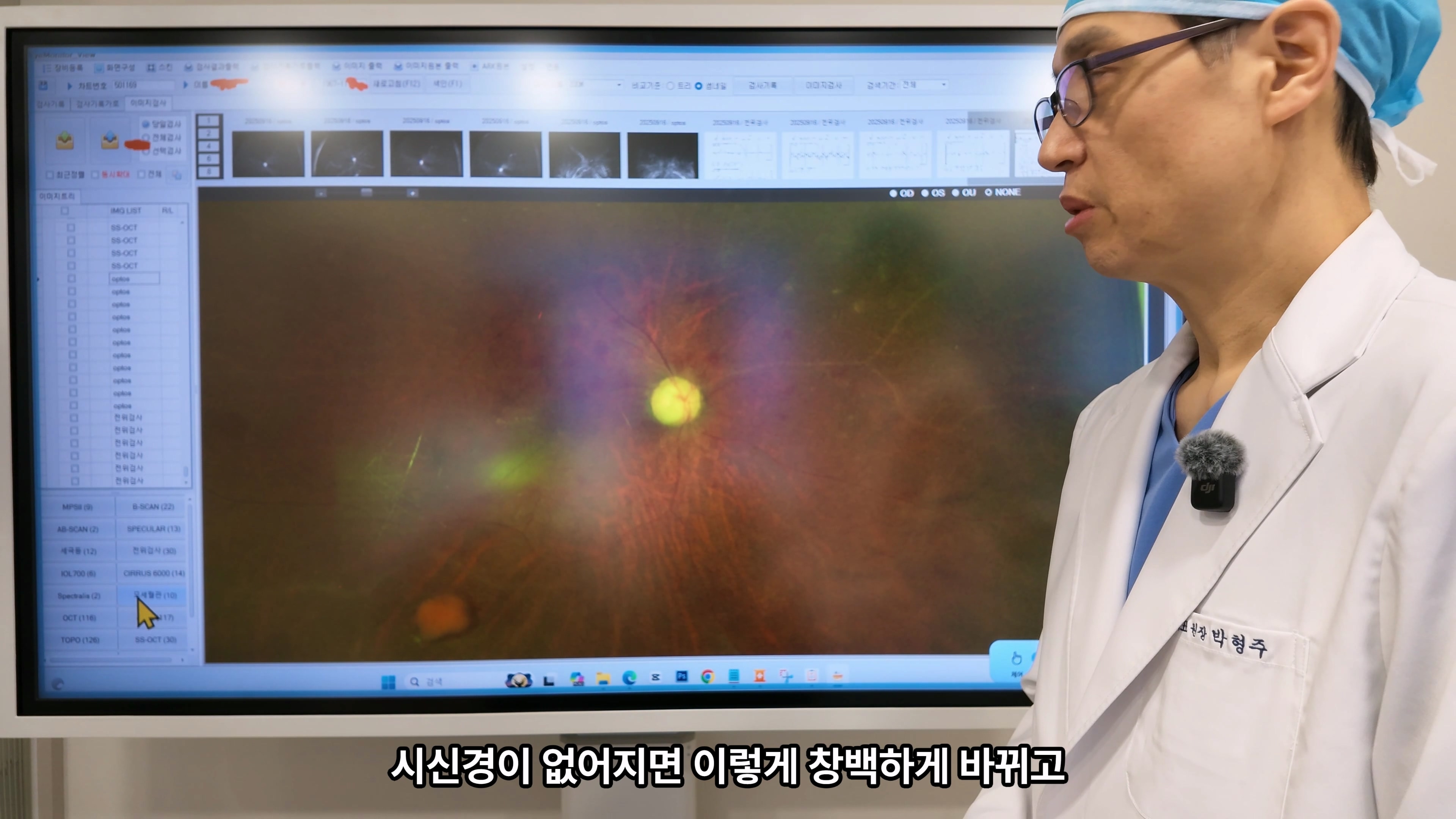 50대 후반 녹내장, 좌안 실명과 우안 터널시야에서 살펴본 신생혈관녹내장 치료 과정