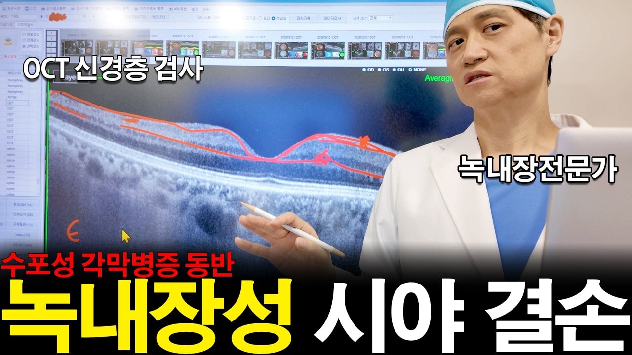 녹내장 재수술이 필요한 경우, 각막손상과 시야손상을 함께 본 60대 녹내장 사례