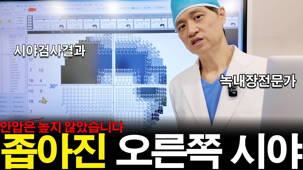 60대후반 녹내장, 안압상승 확인 후 우안 섬유주절제술까지 본 이유