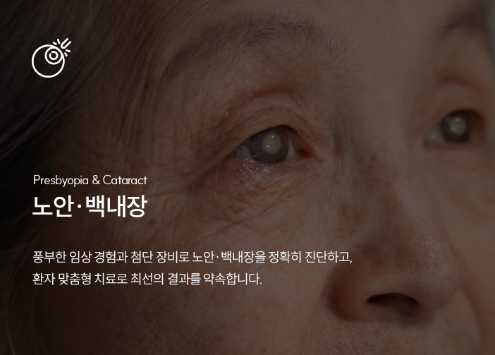 녹내장 이미지