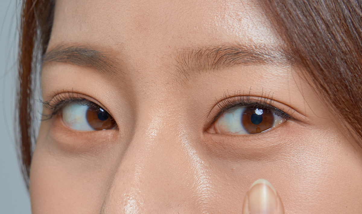 최소 침습 수술